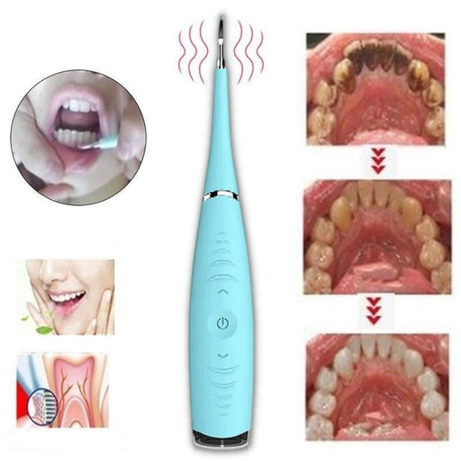 Cepillo,de,dientes,eléctrico,de,silicona,para,cálculo,dental,Limpiador,de,dientes,electrico,para,placa,de,manchas,de,dientes,de,sarro,de,calculo,dental,Azul