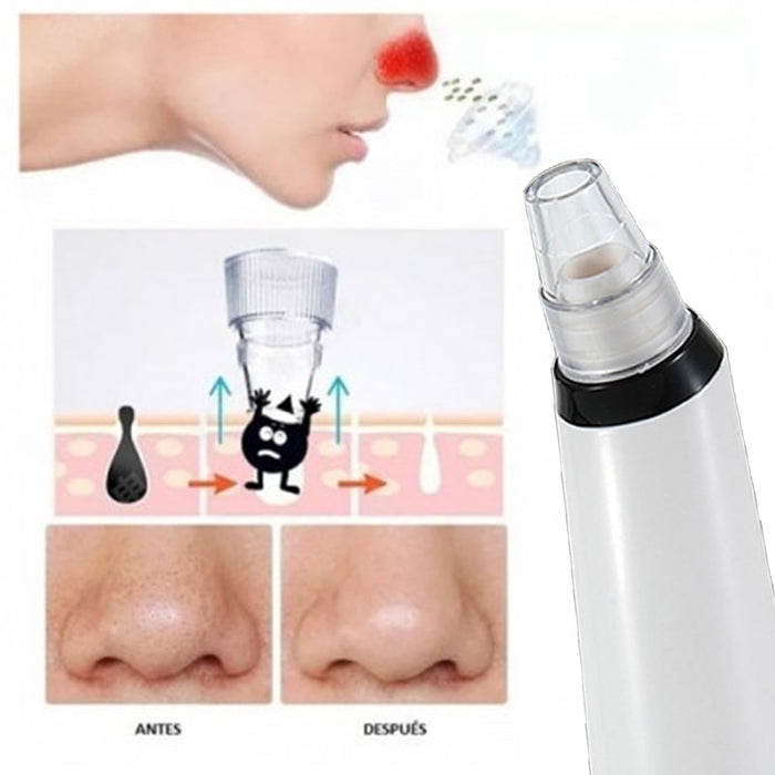 Succionador de poros con 6 cabezales intercambiables | BronBeauty©