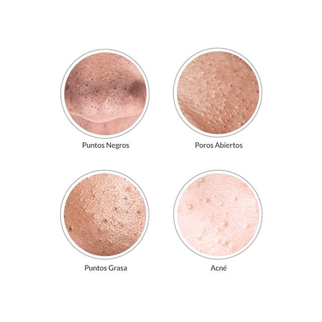 Limpiador,Facial,de,Poros,y,Puntos,Negros,BronBeauty©,moin,limpiador,de,poros,instrucciones,succionador,de,poros,opiniones,succionador,de,poros,mercadona,aspirador,puntos,negro,opiniones,limpiador,puntos,negro,bronmart,mejor,succionador,de,poros,limpiador,puntos,negro,succionador,de,poros,bronmart,ES